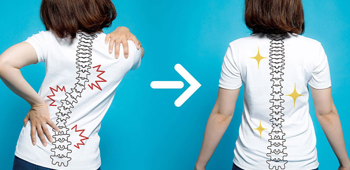 Chiropractic for good posture in Roseville