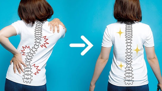Chiropractic for good posture in Roseville