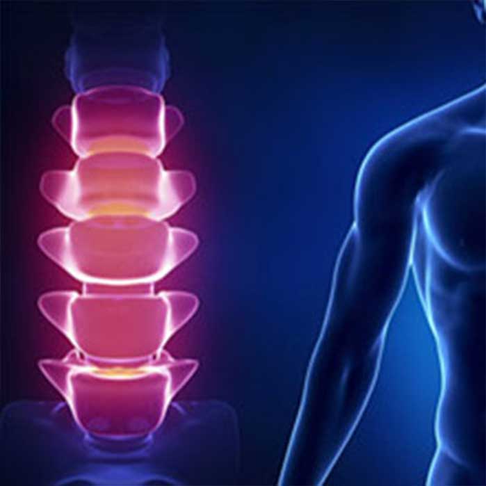 Chiropractic care for lower back pain in Roseville