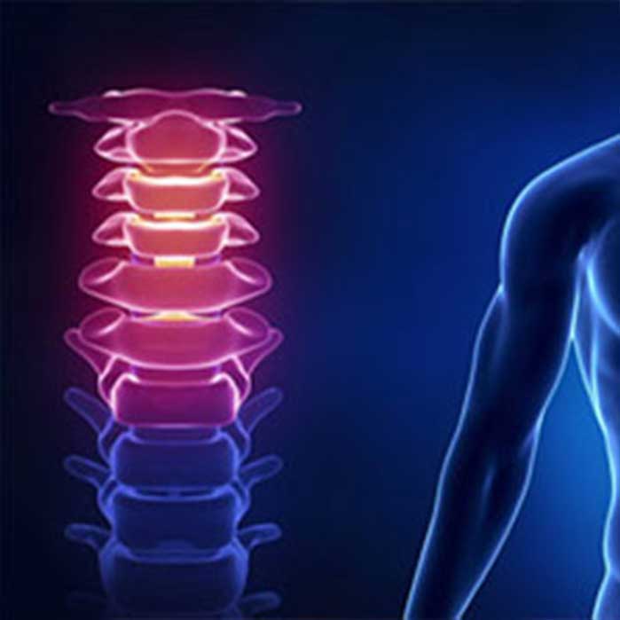 Chiropractic care for neck pain in Roseville