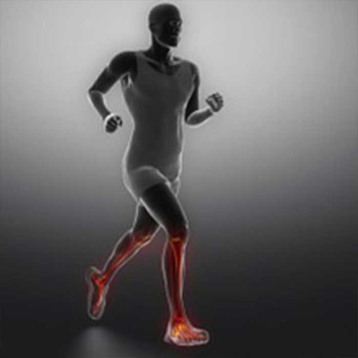 Orthotics in Roseville