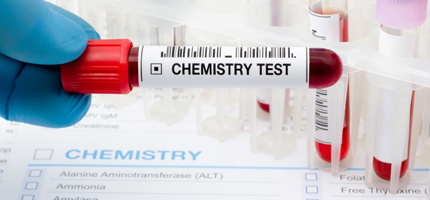 Laboratory and Blood Chemistry Testing in Roseville for knee pain relief