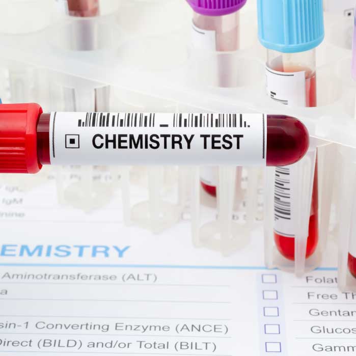 Laboratory and Blood Chemistry Testing in Roseville